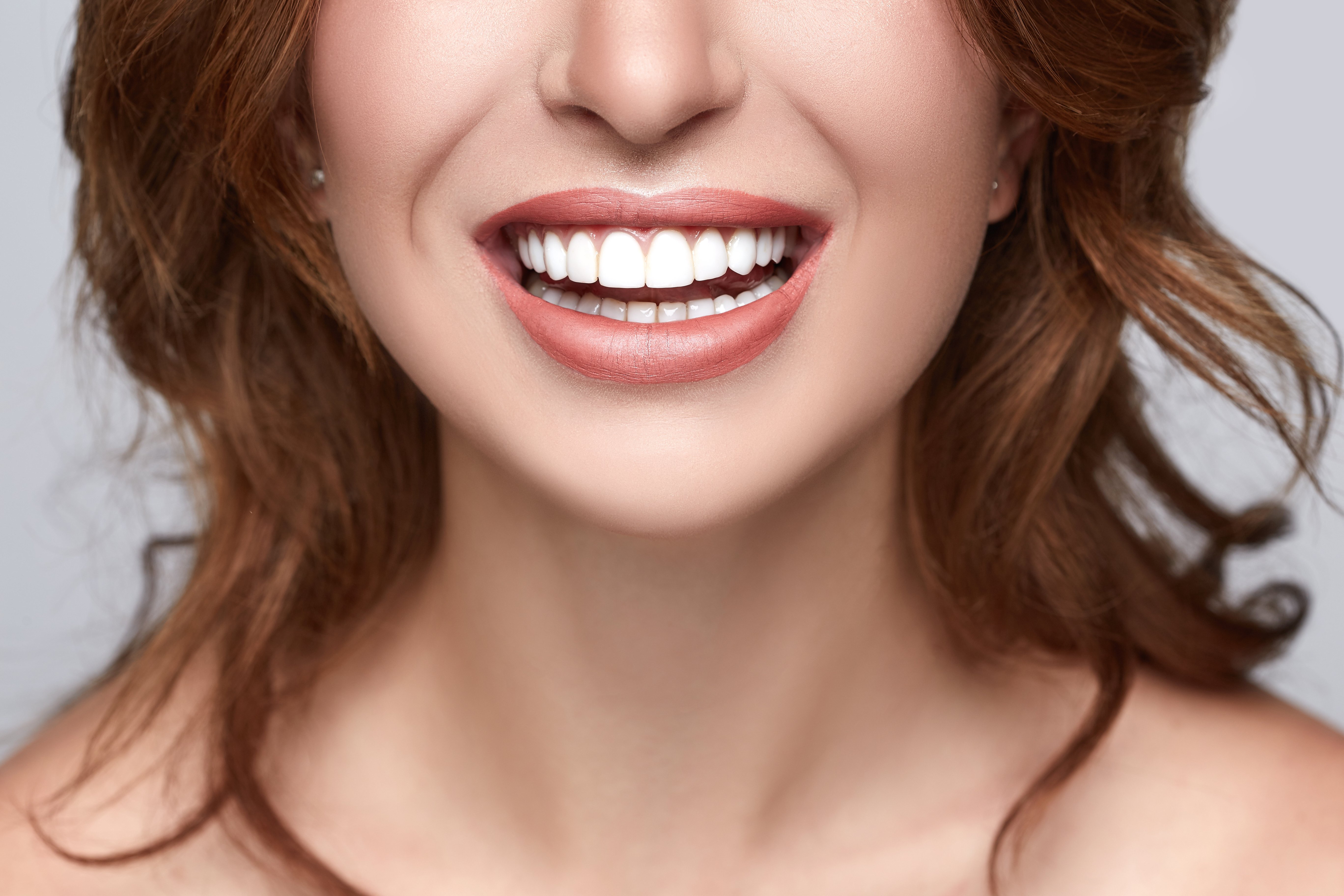 Close-up de sonrisa con dientes perfectos. Fuente: Shutterstock