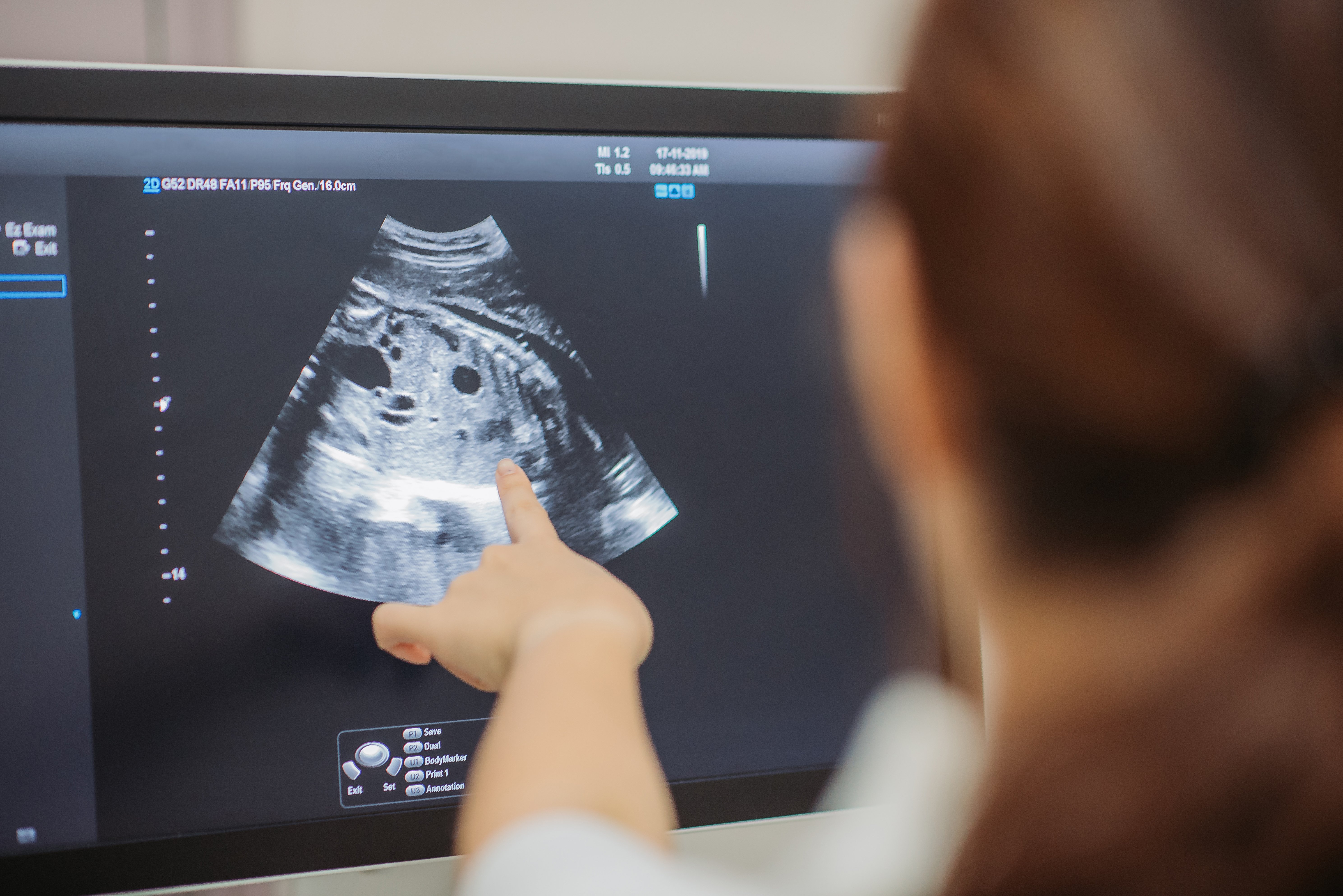 Doctor explains ultrasound to parents. | Source: Getty Images 