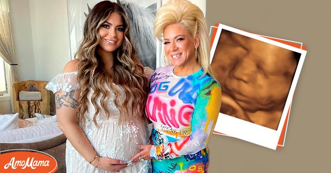 Victoria and Theresa Caputo pictured at Victoria's baby shower in 2021 [Main Image] A sonogram of Victoria's baby she shared on Instagram [Smaller Image]. | Photo: instagram/theresacaputo  instagram/viccaputo