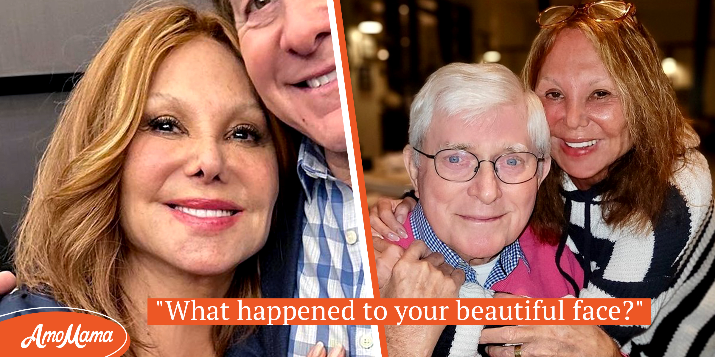 Marlo Thomas Face Labeled Weird But Her Spouse Accepts Her As She Is They Once Split Months