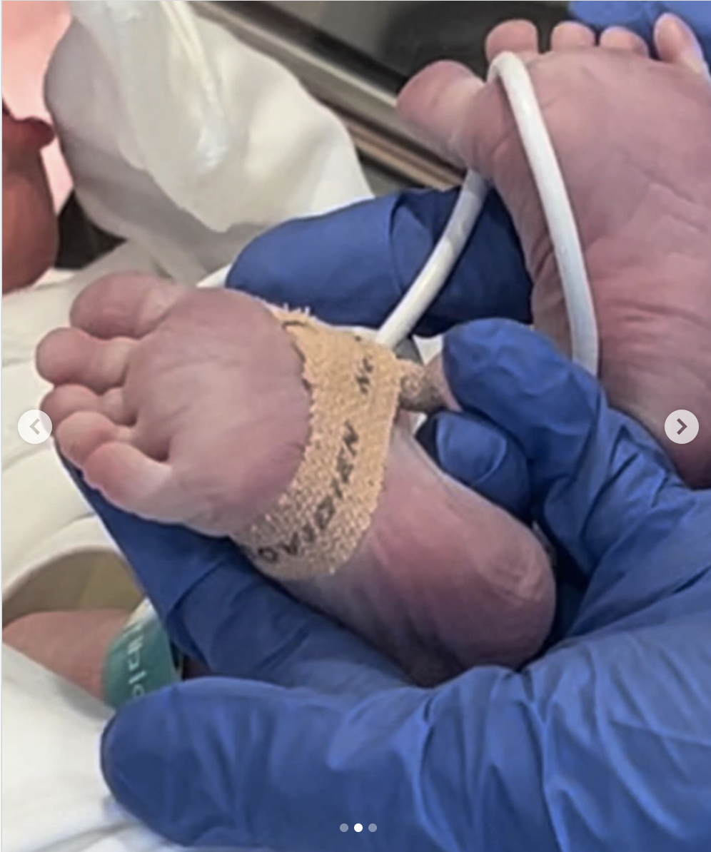 Tron Austin's newborn daughter's feet, dated March 2024 | Source: Instagram/Timeflybye