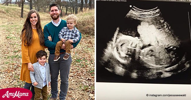 Jessa Duggar compares her third as-yet-unborn child's nose with her two others from a first scan