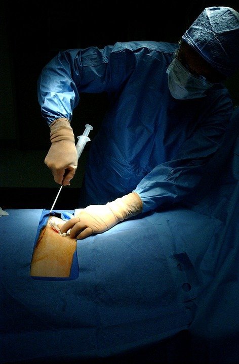 Cirugía. | Imagen tomada de: Pixabay