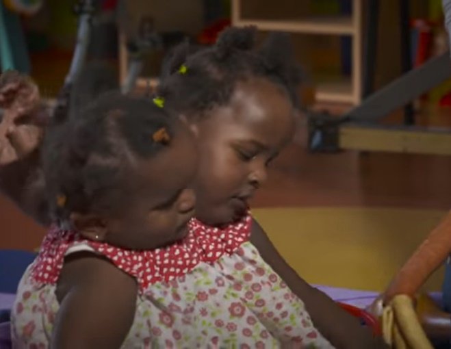 Las siamesas Ndeye y Marieme Ndiaye. | Foto: YouTube/BBC News Las siamesas Ndeye y Marieme Ndiaye. | Foto: YouTube/BBC News