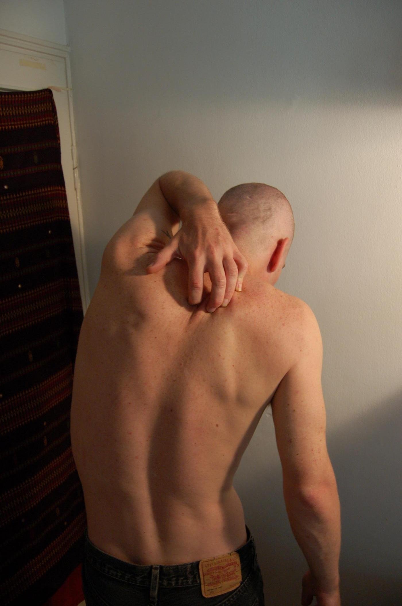 Hombre rascando su espalda | Imagen tomada de: Wikimedia Commons