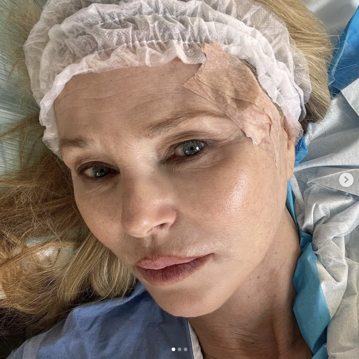 Christie Brinkley after her procedure, dated March 2024 | Source: Instagram/ChristieBrinkley