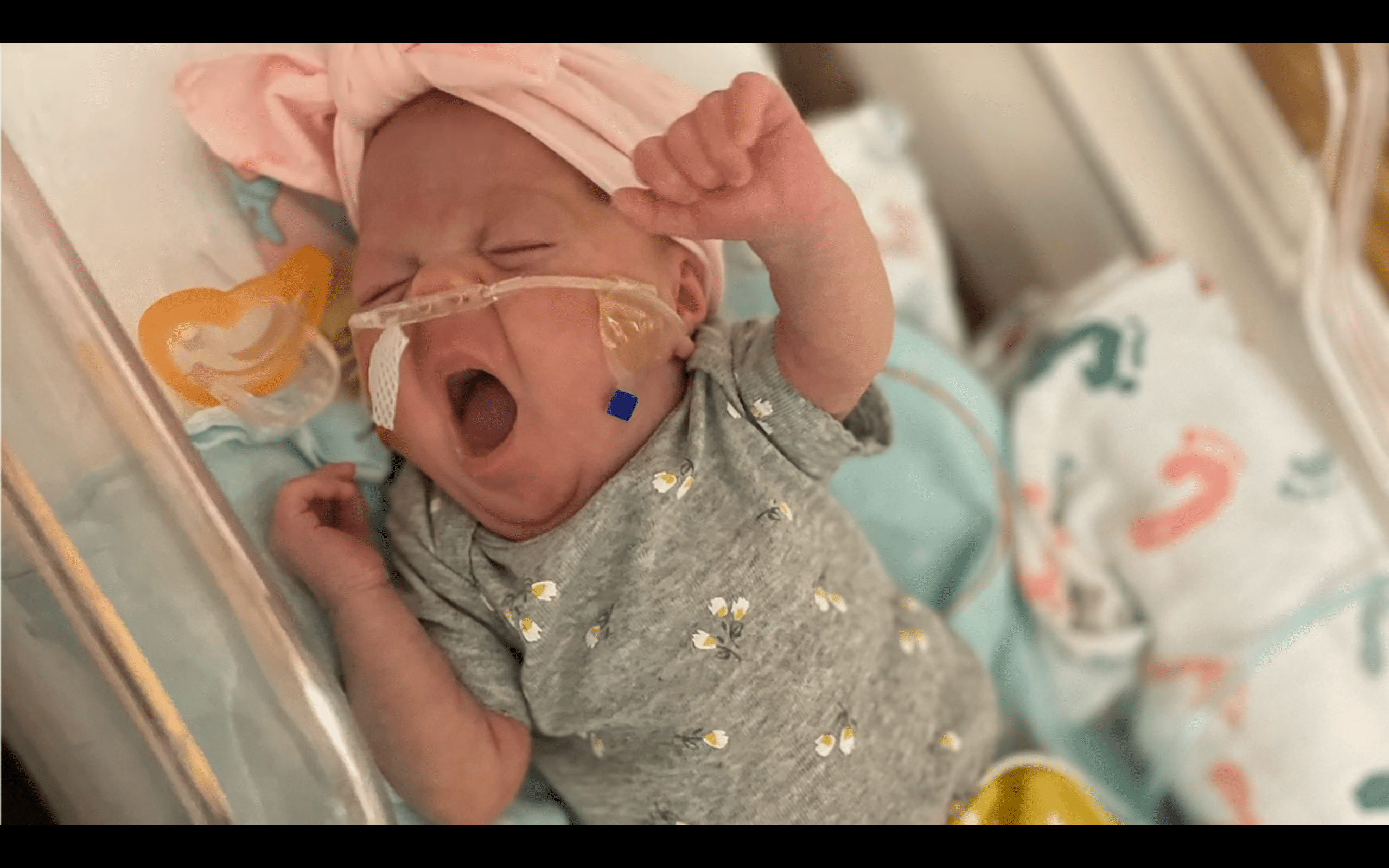 Prematue baby who survived being born at 22 weeks. | Photo: YouTube/Rizzbag