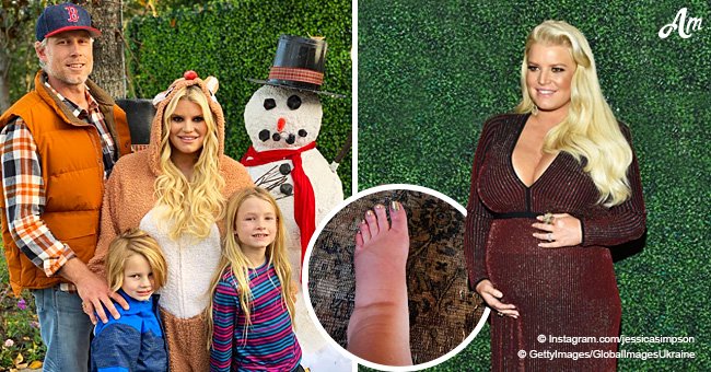 Pregnant mom Jessica Simpson pleads to fans for 'help' after posting horribly swollen foot