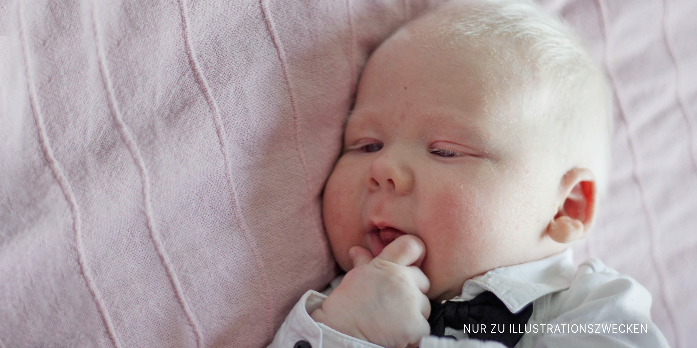 Baby mit Albinismus auf einer Decke liegend | Quelle: Shutterstock