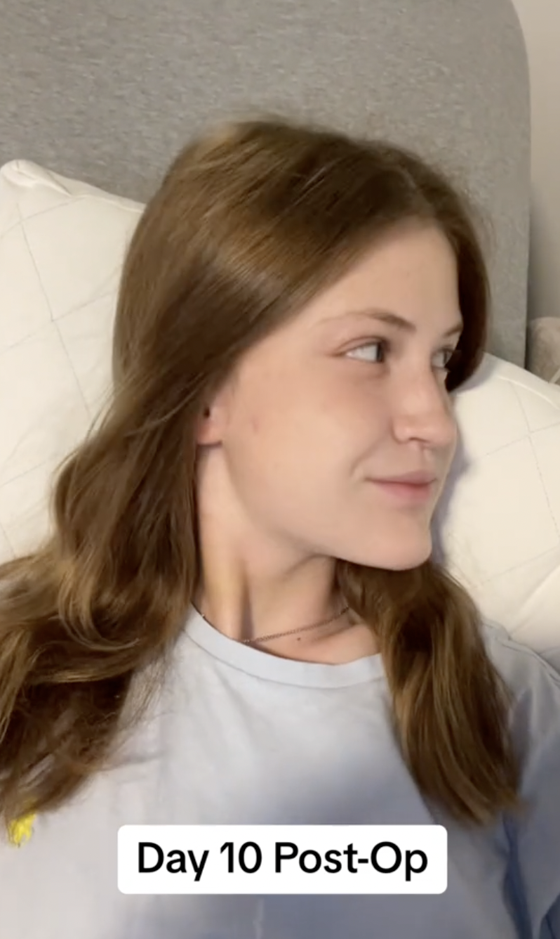 Ten days into recovery, Virginia Elder offers a soft smile while glancing to the side. | Source: TikTok/virginiaeelder