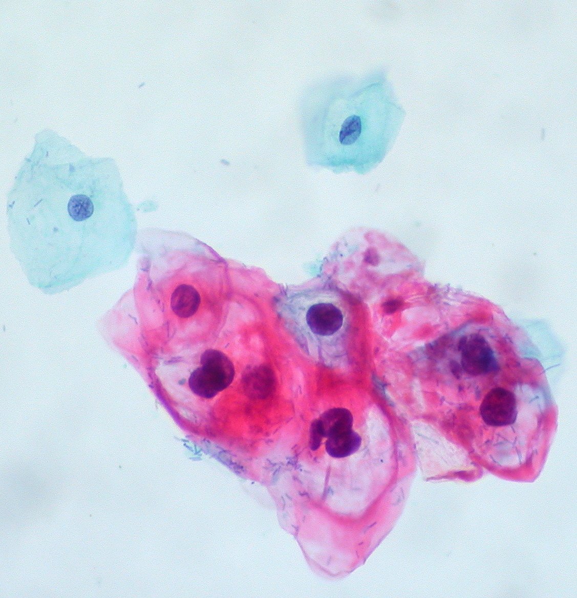 Virus del papiloma humano (VPH). | Imagen: Wikimedia Commons