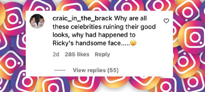 A fan comments on Ricky Martin's facial appearance, from a post dated November 3, 2024 | Source: Instagram/people/