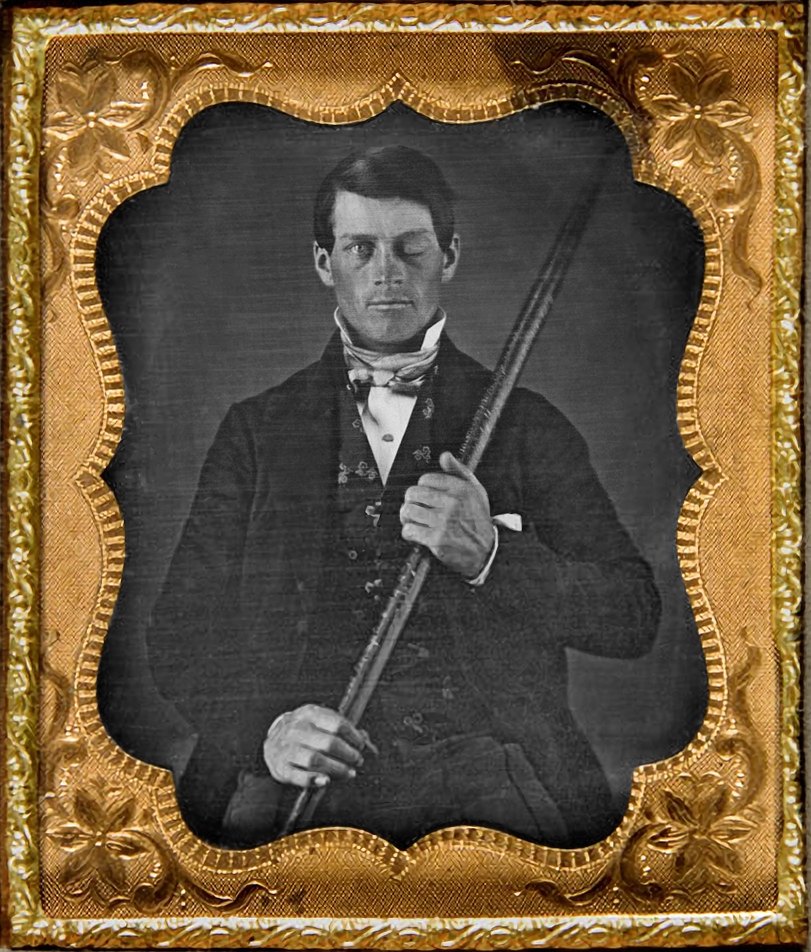 Source: Image of Phineas Gage| Source: Wikipedia/Photograph by Jack and Beverly Wilgus of daguerreotype originally from their collection, and now in the Warren Anatomical Museum, Center for the History of Medicine, Francis A. Countway Library of Medicine, Harvard Medical School./CC BY-SA 3.0