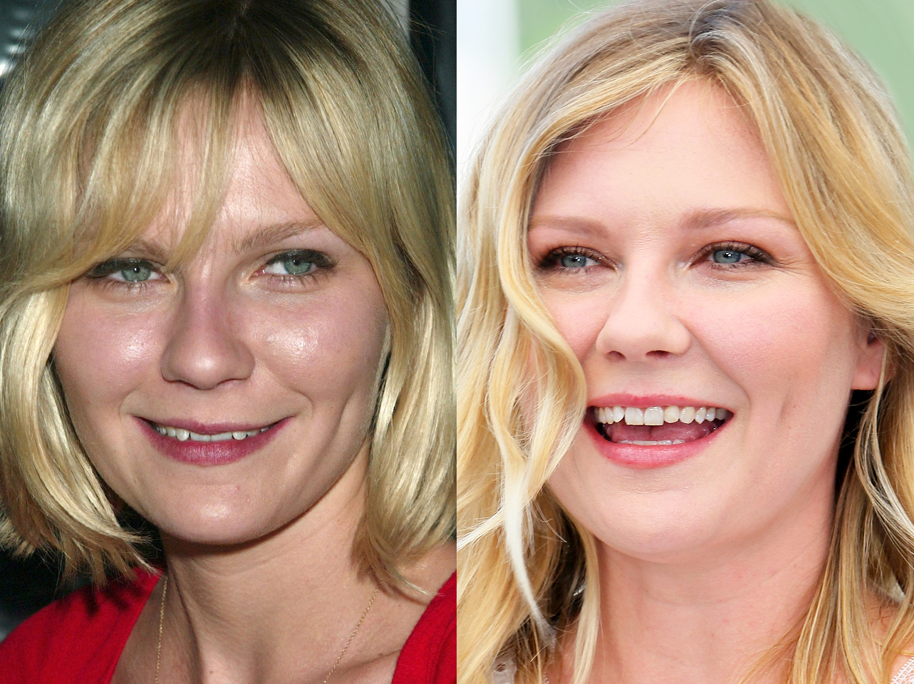 A before and after of Kirsten Dunst's smile. | Source: Getty Images
