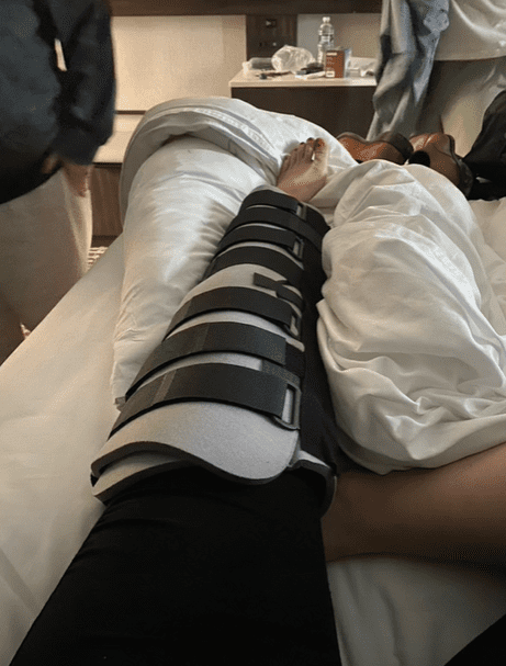 Julie Benn's injured leg in cast. | Source: tiktok.com/ liz_richter