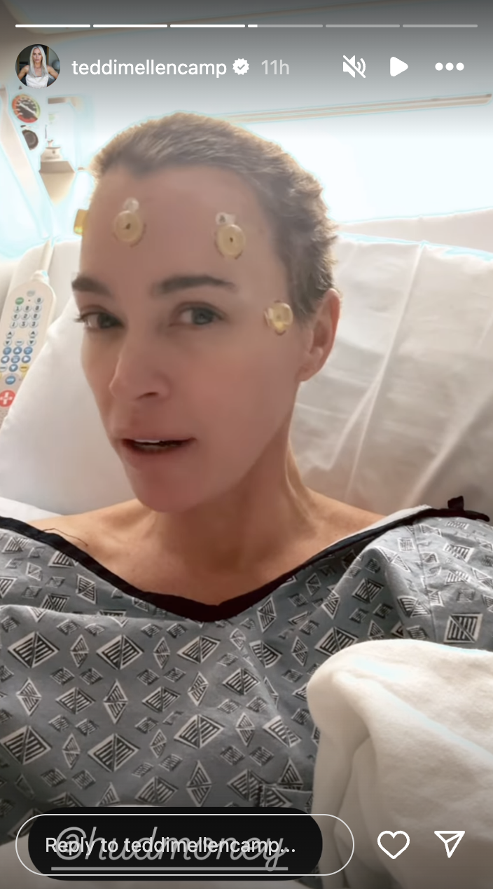 Teddi Mellencamp in the hospital with small suctions placed on her forehad, as seen in her Instagram Story | Source: Instagram/teddimellencamp