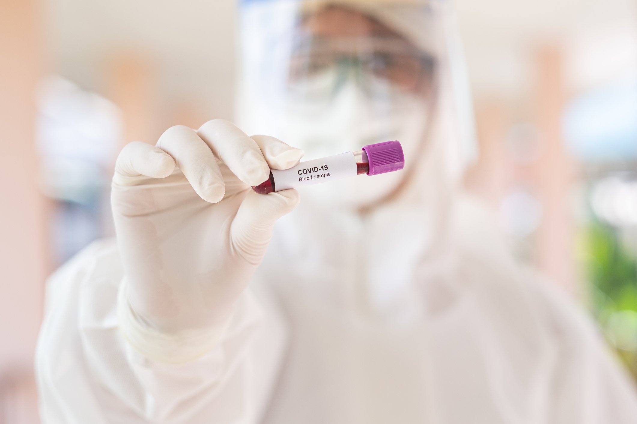 Photo of a doctor holding a Covid-19 Blood Sample | Photo: Getty Images