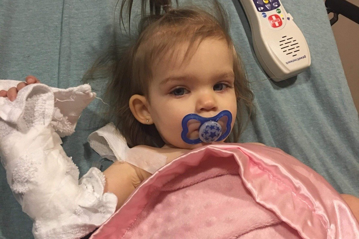 Callie June, paciente con cáncer. | Foto: GoFundMe Callie June, paciente con cáncer. | Foto: GoFundMe