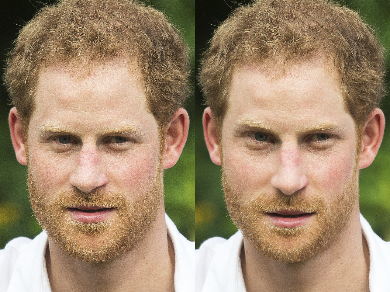 Prince Harry vs how he would look with the Golden Ratio | Source: Getty Images