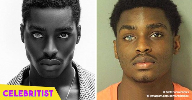 Former inmate with different-colored eyes lands modeling career after mugshot goes viral