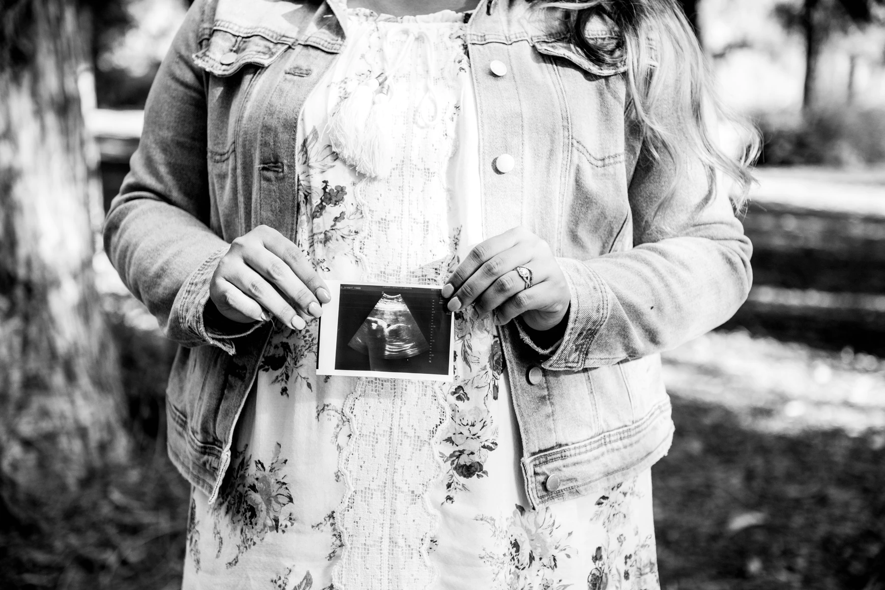 A woman holding ultrasound result film. | Source: Unsplash