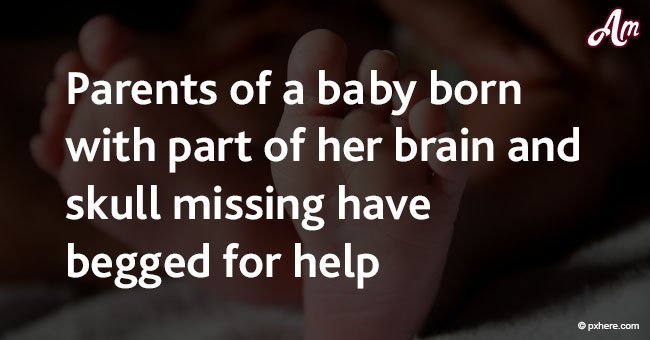 Parents of a baby born with part of her brain and skull missing have begged for help