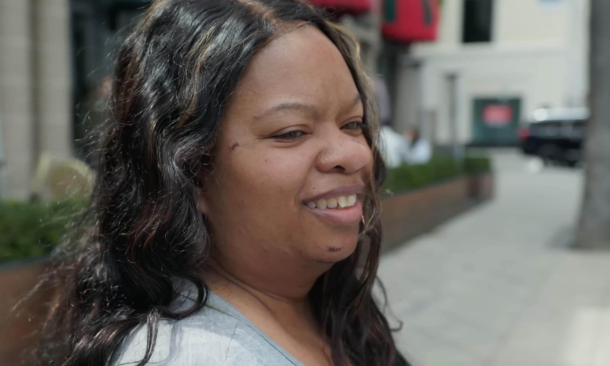 Danielle after surgery dated August 2, 2024 | Source: You Tube/@Dr.Truesdale