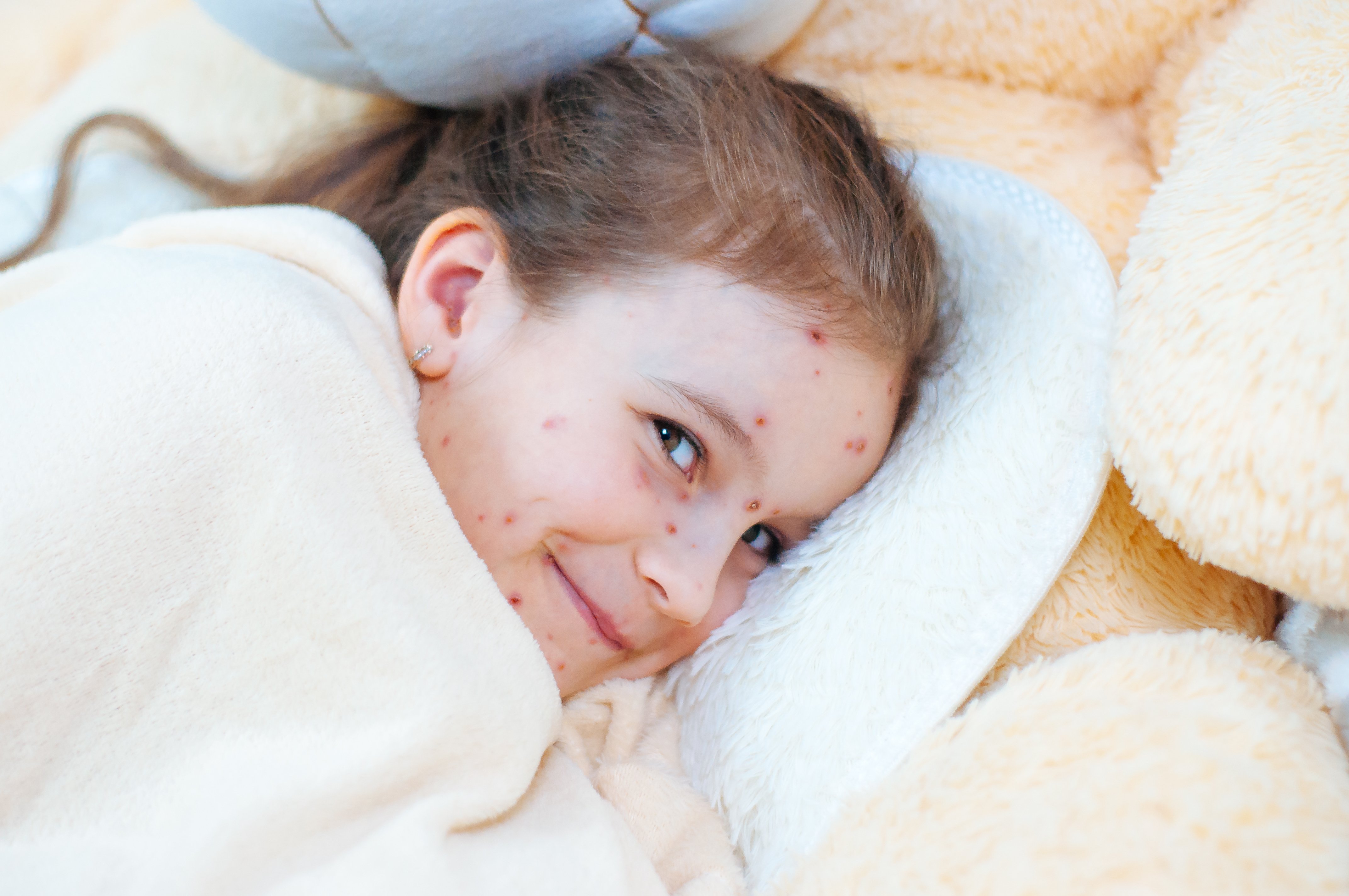 Une petite fille malade. | Photo : Shutterstock