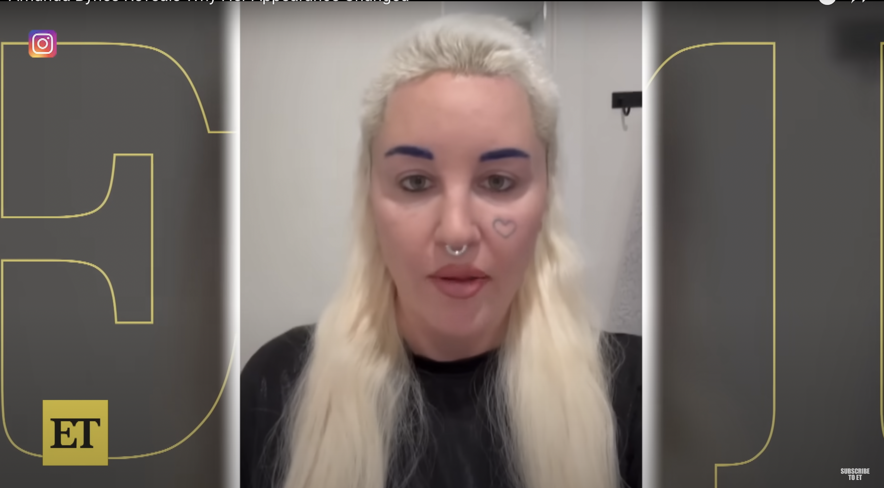 A screenshot of Amanda Bynes from a clip where she reveals undergoing cosmetic surgery for her eyelids, published on December 13, 2023 | Source: Youtube/entertainmenttonight