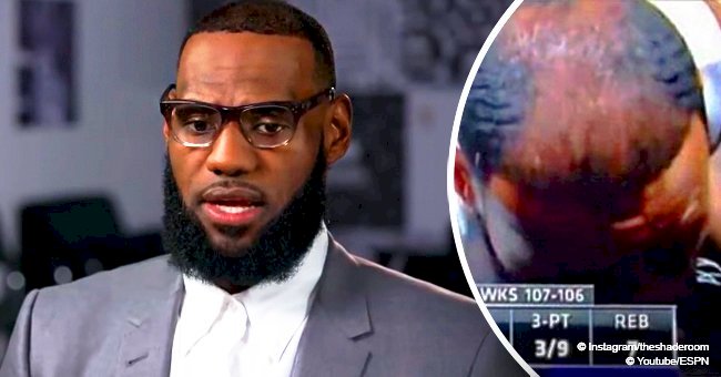 LeBron James gets clowned again after new photo of his bald spot went viral