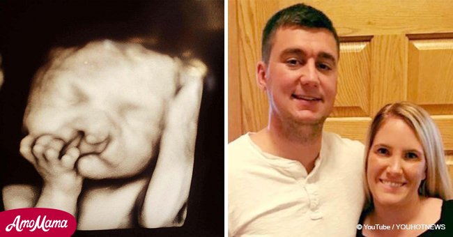 Die Ärzte schlugen den Eltern vor, das "deformierte" Baby aufzugeben. Schau, wie das Kind jetzt aussieht