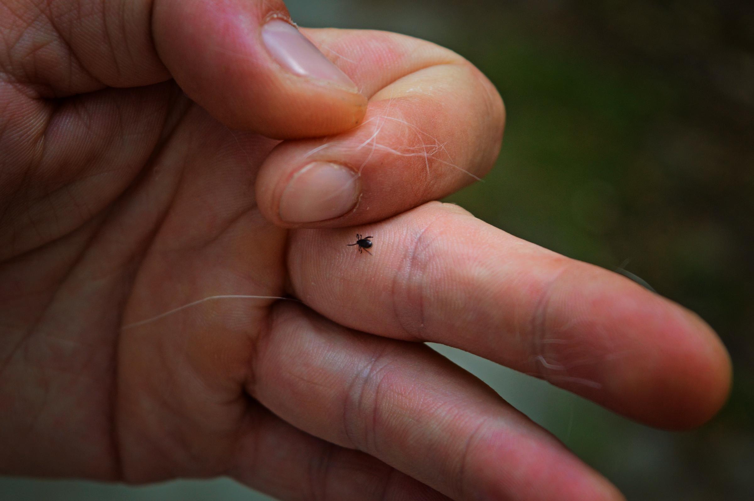 A parasitic tick crawls on the skin of a person's hand | Source: Getty Images