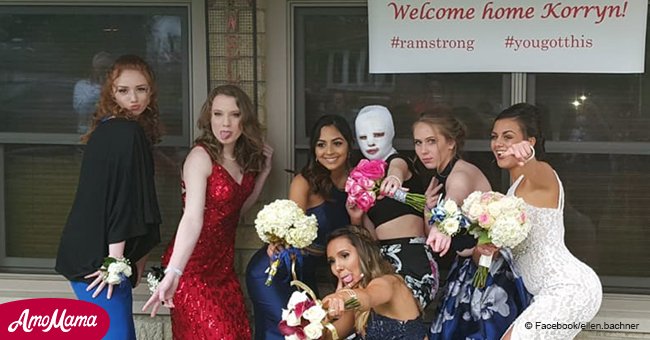 Friends gave 3rd degree burn victim who could not attend prom an emotional surprise