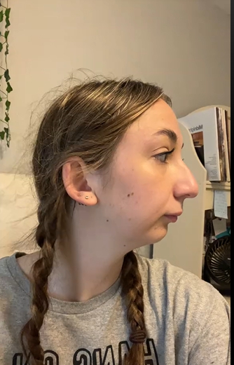 TikToker Maddie before undergoing double jaw surgery from a post dated October 24, 2023. | Source: TikTok/maddieakamofo