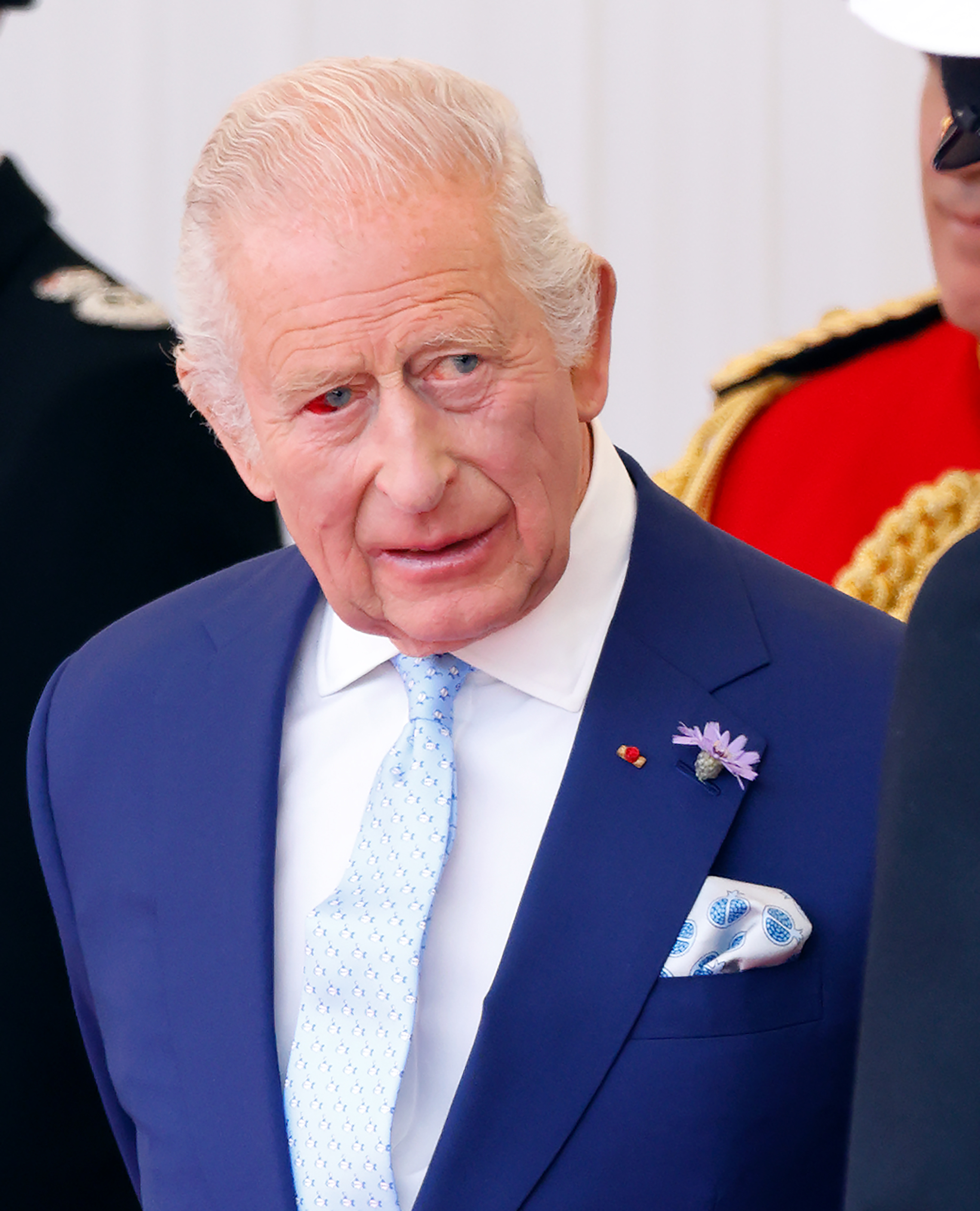 King Charles III's burst blood vessel becomes more apparent in this striking image from the Macrons' welcome ceremony. The monarch, though visibly affected, maintains his diplomatic presence in the company of military personnel.
