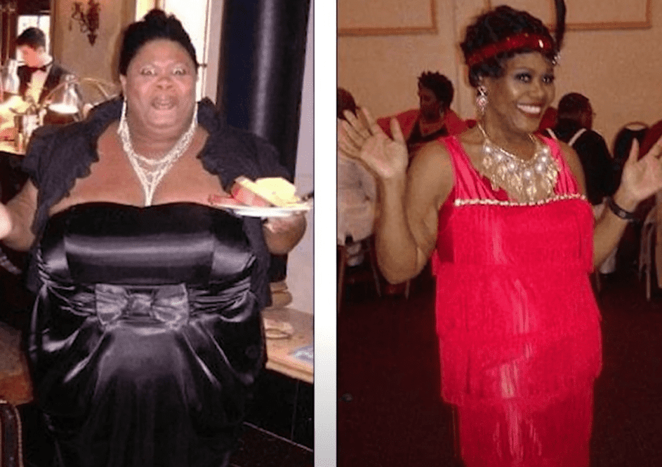 Vorher, nachher Fotos einer Frau, die über 45kg verloren hat. | Quelle: Youtube/TODAY