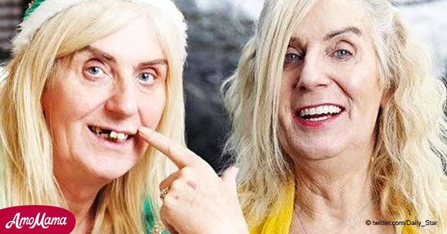 Transgender lottery winner shows off new $54K teeth after losing hers in an attack 7 years ago