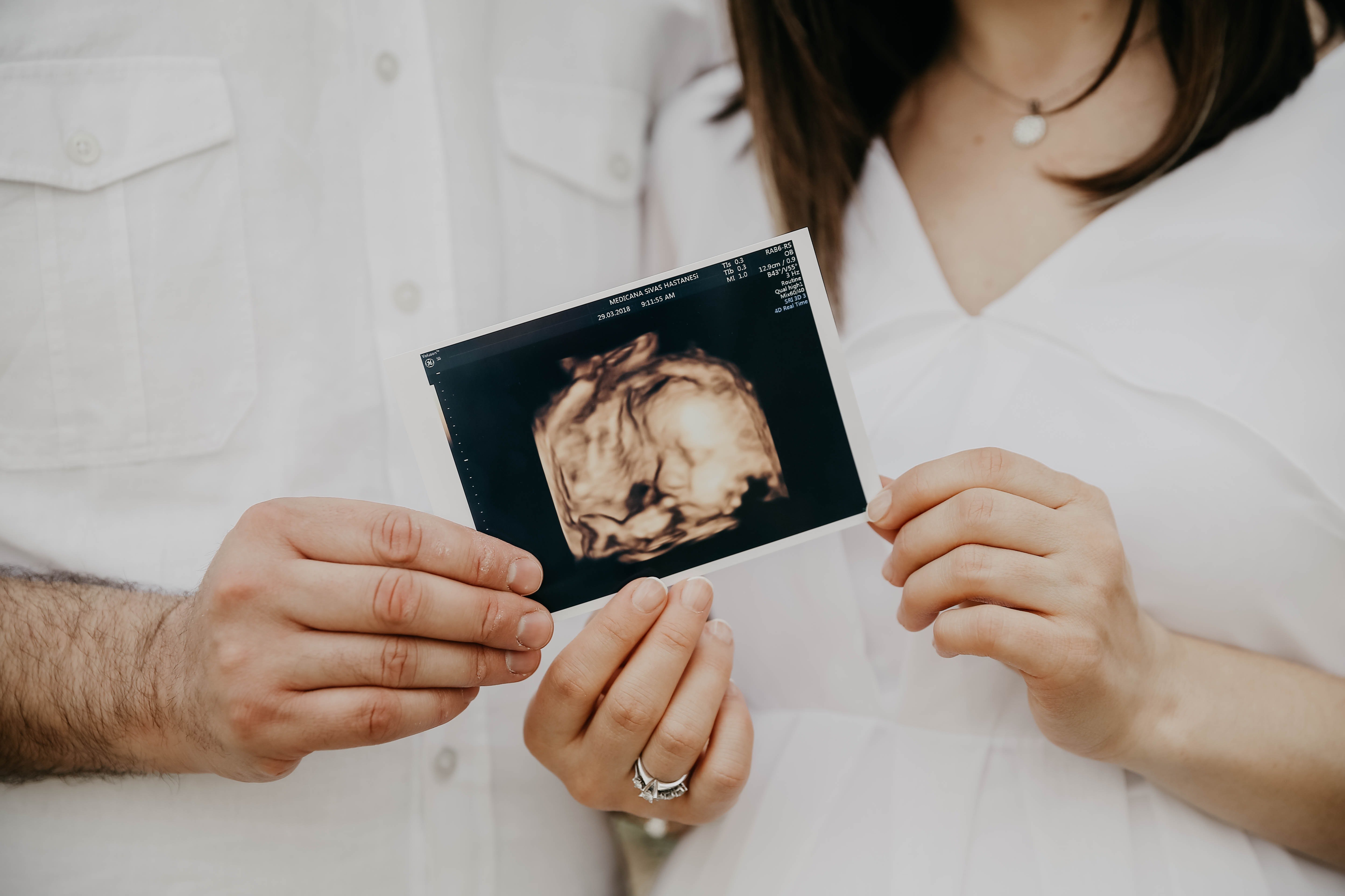 Hugh and Natalie were expecting. | Source: Pexels