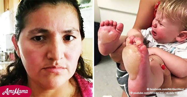 Niñera quemó los pies de un bebé porque lloraba demasiado