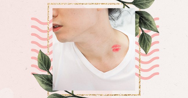 A Guide To Getting Rid Of A Hickey Quick