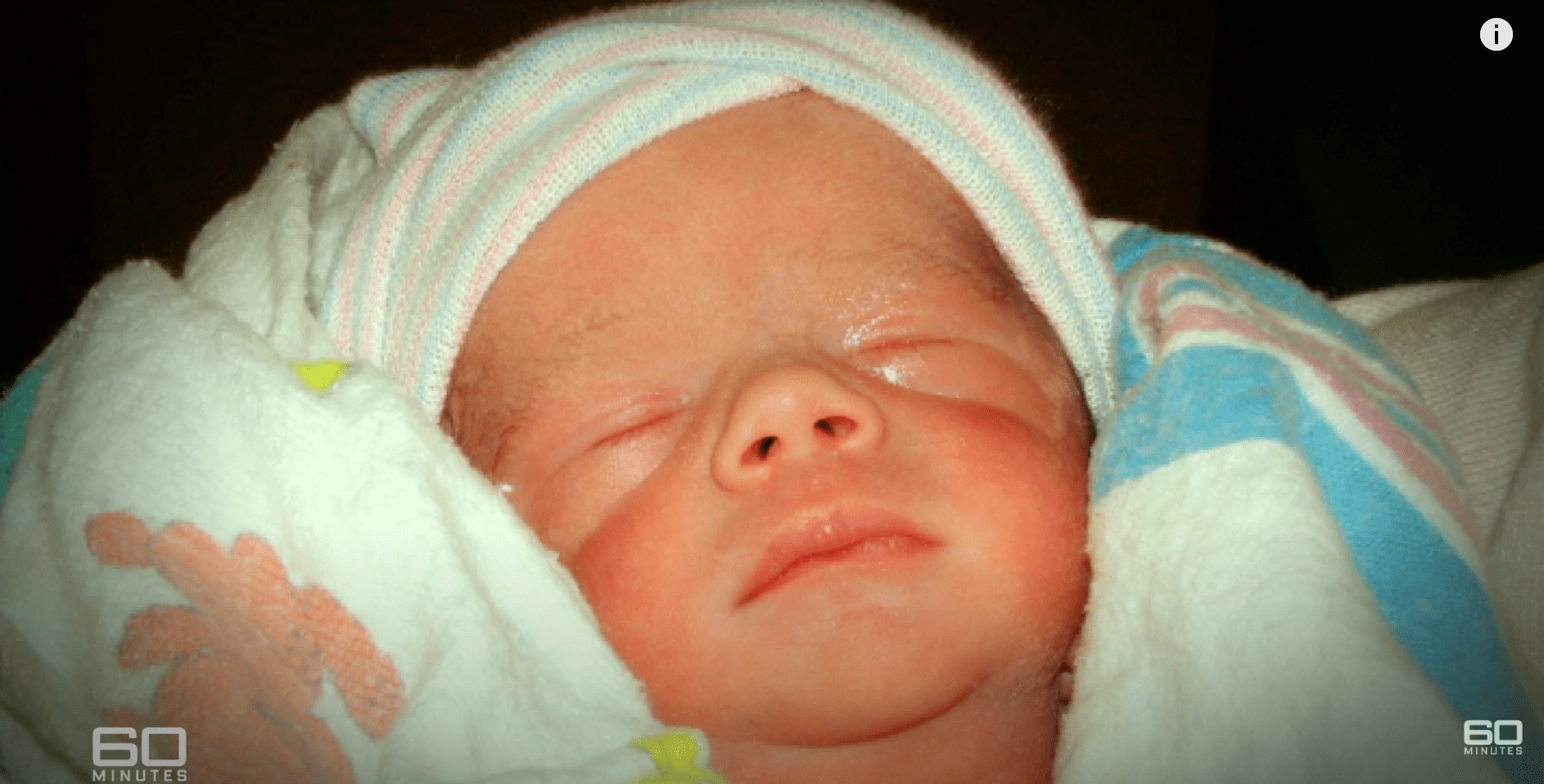 Baby Logan after birth. | Source: youtube.com/60 Minutes Australia