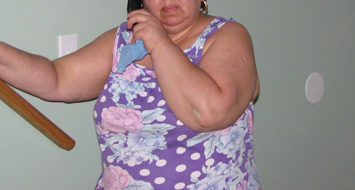 Mujer obesa. | Imagen: Wikimedia Commons
