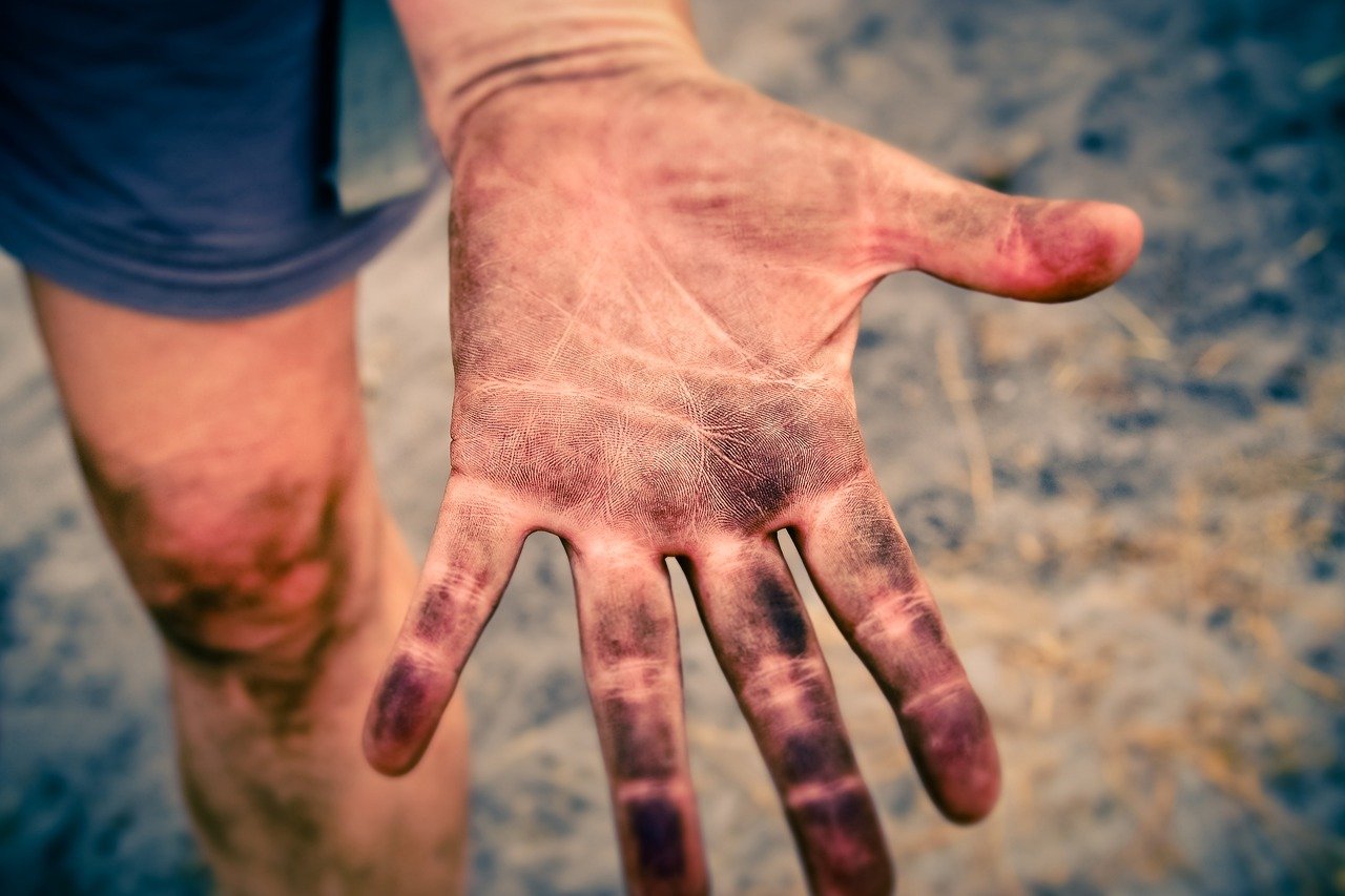 Un niño muestra su mano sucia. | Foto: Pixabay