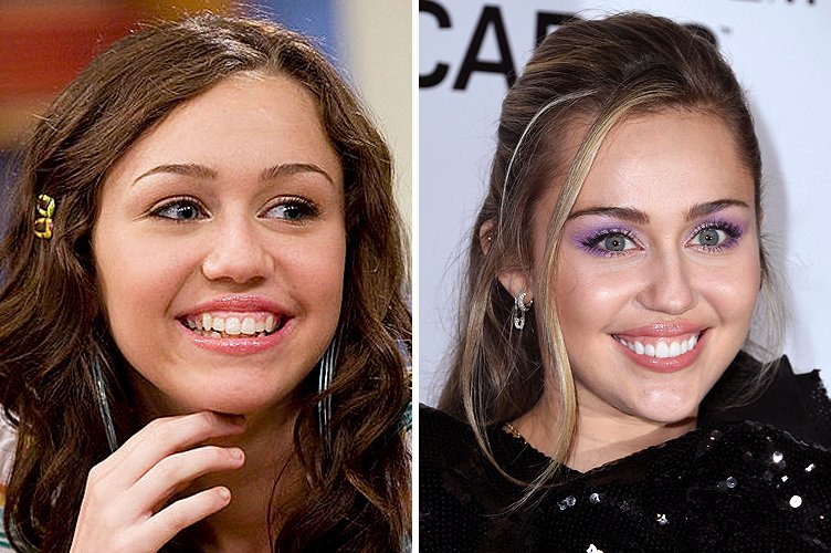 Miley Cyrus avant et après. ǀ Source : Getty Images
