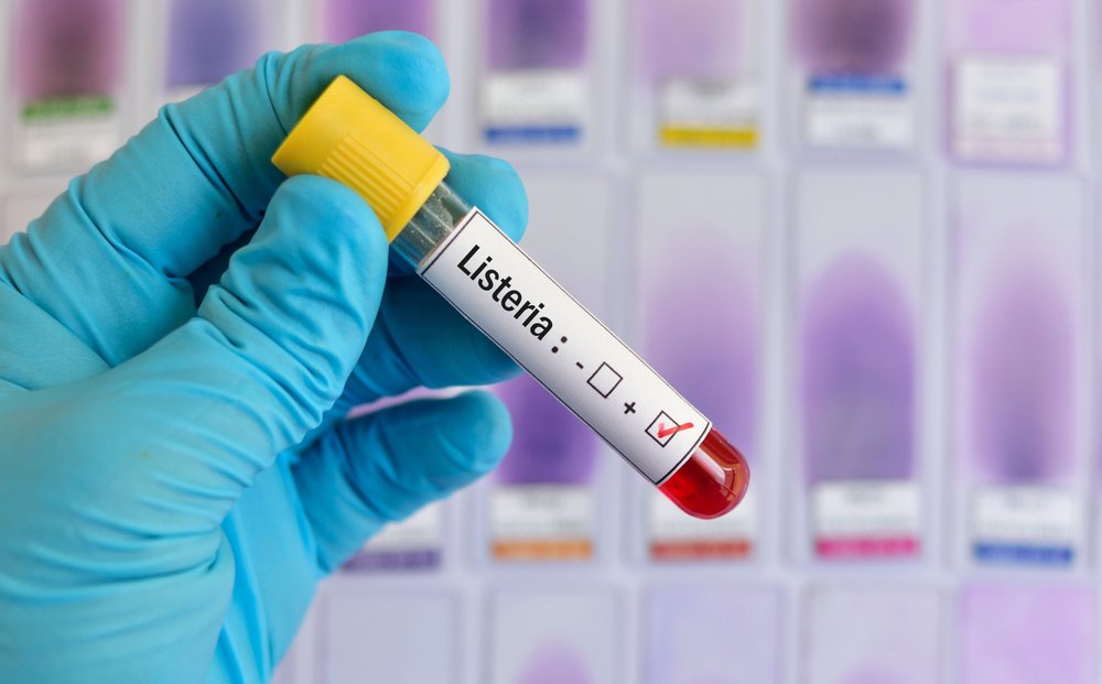 Prueba positiva de Listeria. || Fuente: Shutterstock Prueba positiva de Listeria. || Fuente: Shutterstock