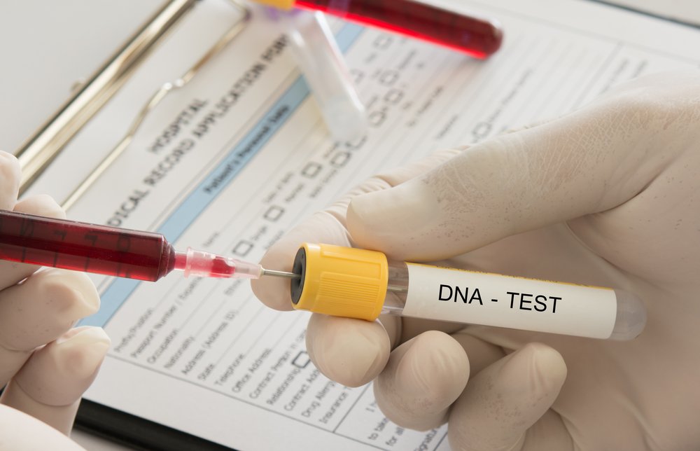 Toma de muestra para test de ADN en laboratorio. | Foto: Shutterstock.
