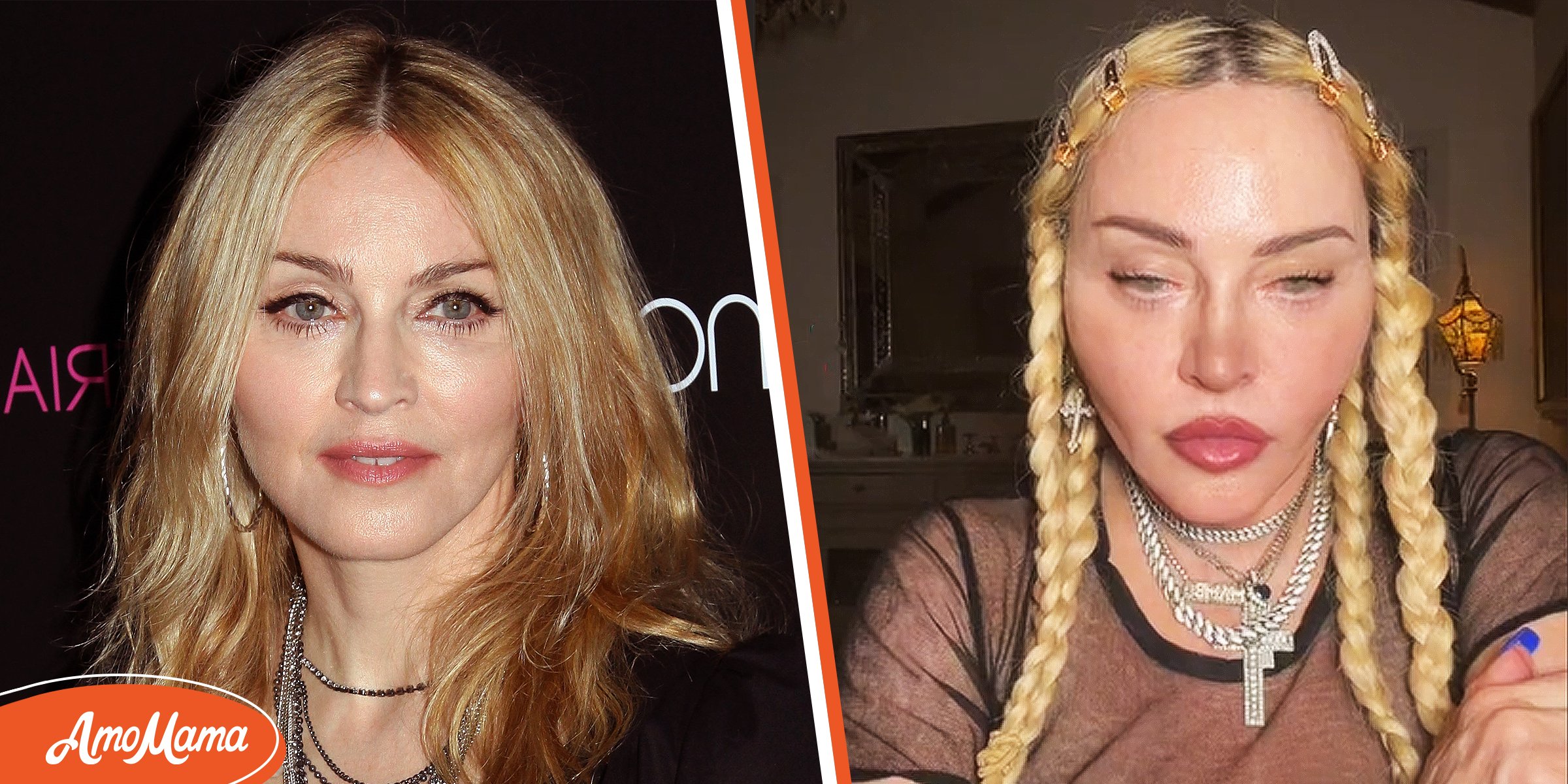 What Did Madonna Do to Her Face? The 63YearOld Singer Looks Youthful