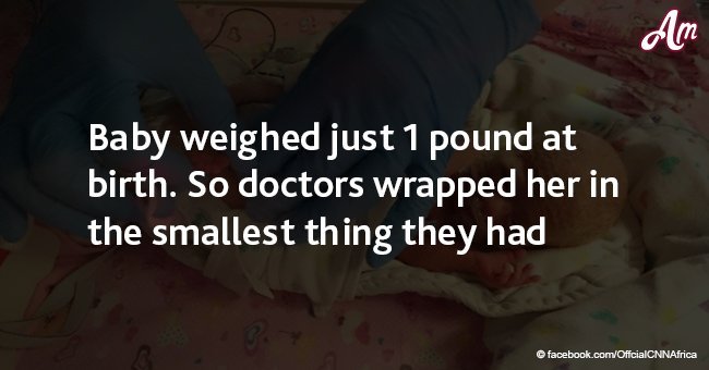 Baby weighed just 1 pound at birth. So doctors wrapped her in the smallest thing they had