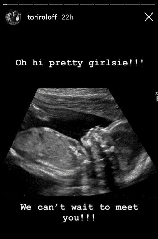 Ultrasound of expected Roloff baby girl | Photo: Instagram Story/Tori Roloff