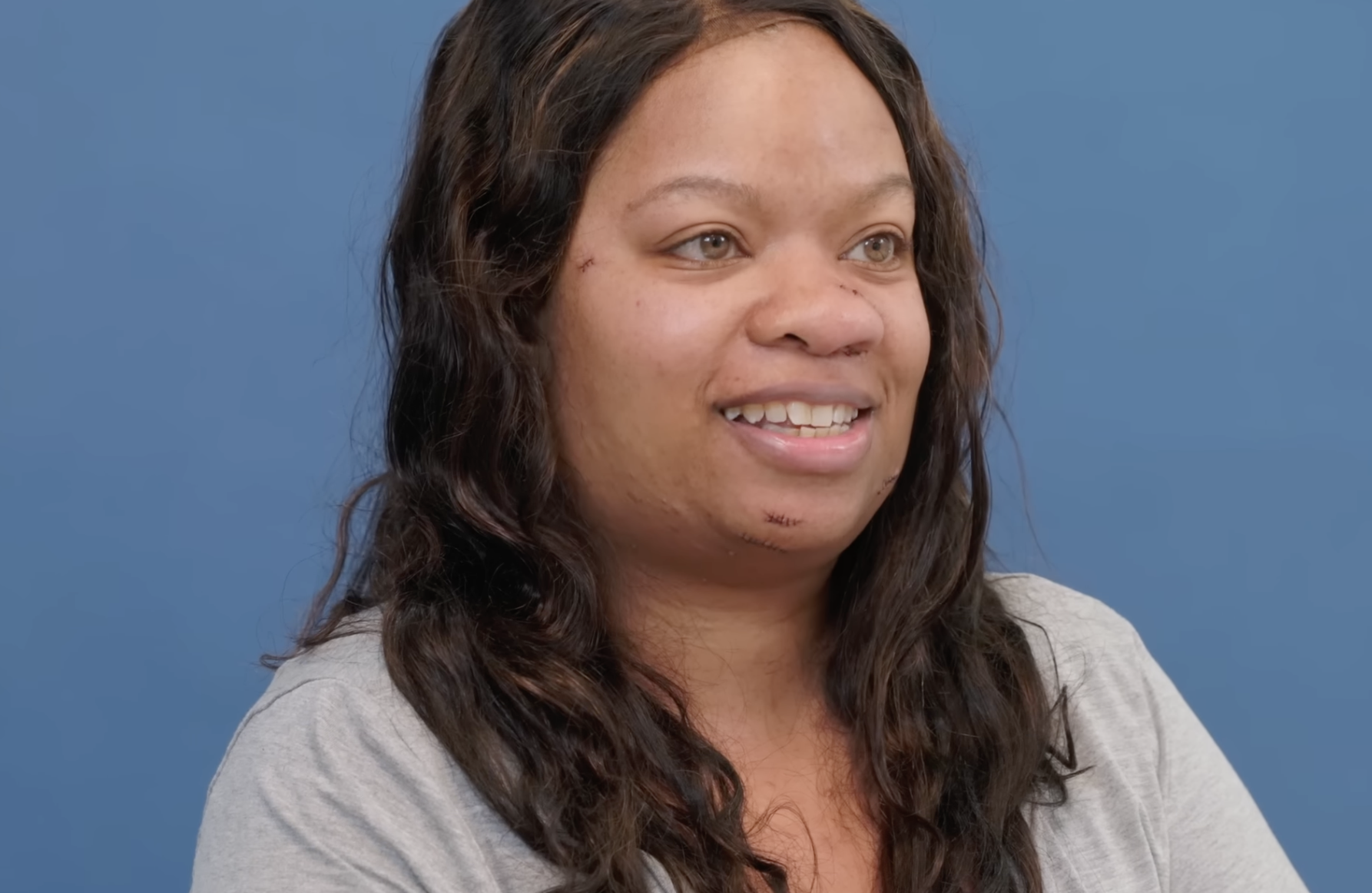 Danielle after surgery, dated August 2, 2024 | Source: YouTube/@Dr.Truesdale